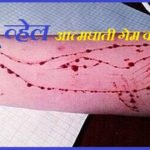 Blue Whale Suicide Game